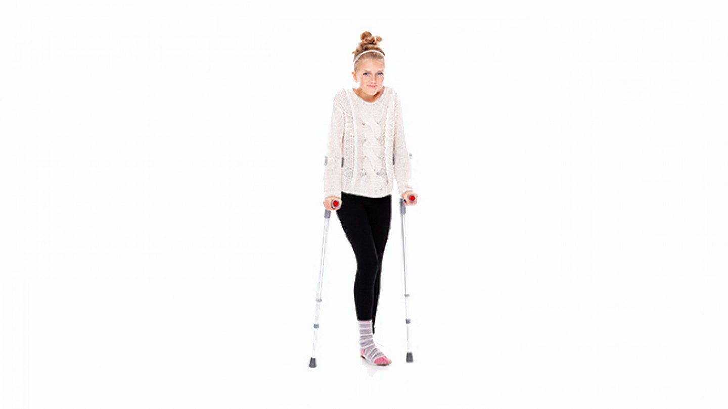 broken leg